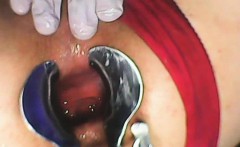 Extreme asshole Gape with Speculum